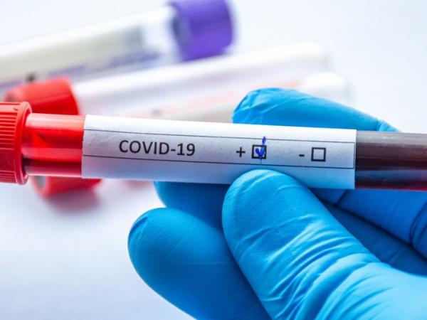 BBC Mundo: Prueba de sangre en un tubo de ensayo que dice covid-19.