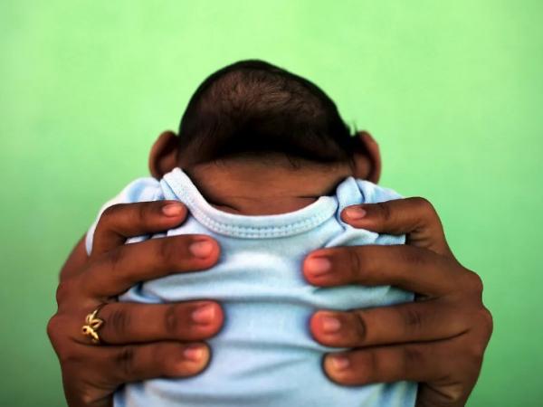 BBC Mundo: Una madre sostiene a su bebé con microcefalia durante la empidemia de zika en América Latina en 2016