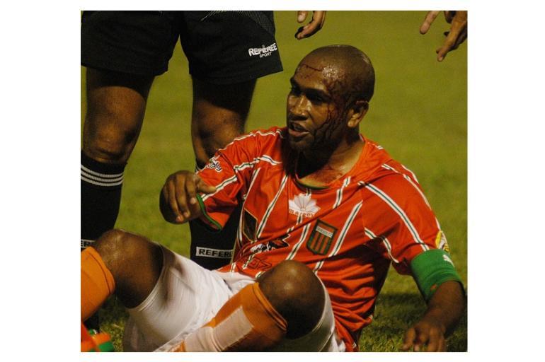 Jugadores más expulsados de la Liga