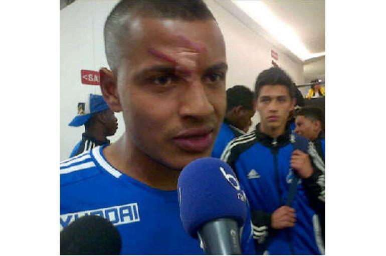 Jugadores más expulsados de la Liga